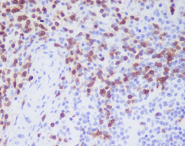 2 - Anti-CD3D Rabbit Monoclonal Antibody ABO13487