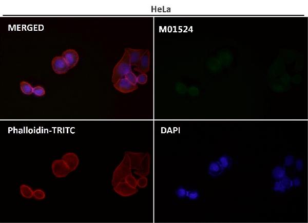 1 - Anti-LC3B MAP1LC3B Rabbit Monoclonal Antibody ABO13488