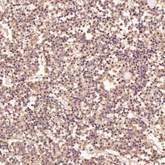 2 - Anti-LC3B MAP1LC3B Rabbit Monoclonal Antibody ABO13488