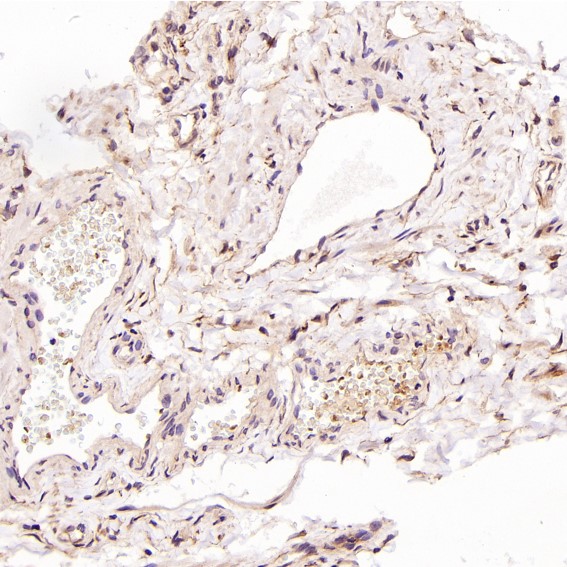 2 - Anti-LC3B MAP1LC3B Rabbit Monoclonal Antibody ABO13488