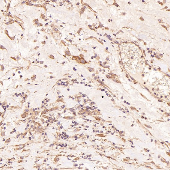 2 - Anti-LC3B MAP1LC3B Rabbit Monoclonal Antibody ABO13488