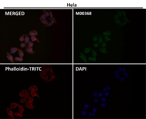 1 - Anti-iNOS NOS2 Rabbit Monoclonal Antibody ABO13489