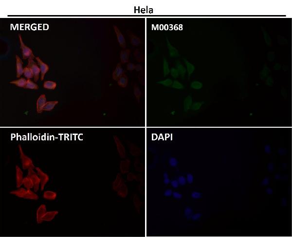 1 - Anti-iNOS NOS2 Rabbit Monoclonal Antibody ABO13489