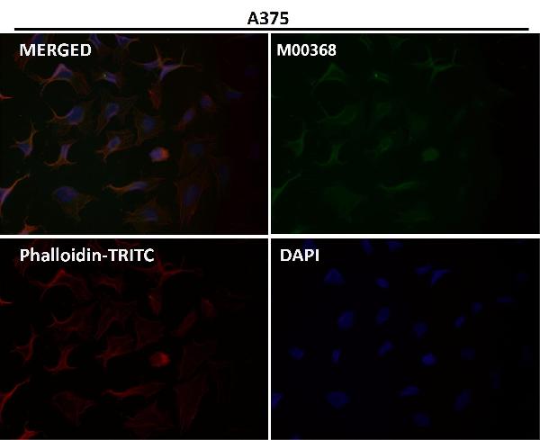 1 - Anti-iNOS NOS2 Rabbit Monoclonal Antibody ABO13489