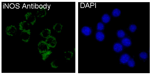 3 - Anti-iNOS NOS2 Rabbit Monoclonal Antibody ABO13489