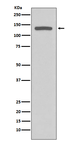 1 - Anti-iNOS NOS2 Rabbit Monoclonal Antibody ABO13489