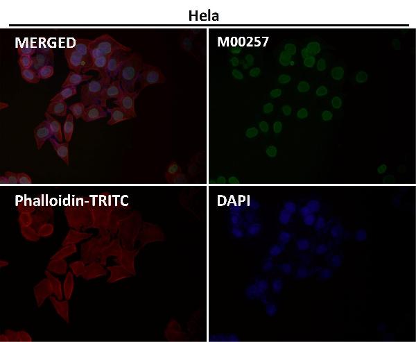 1 - Anti-E2F1 Rabbit Monoclonal Antibody ABO13491