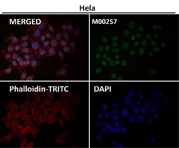 1 - Anti-E2F1 Rabbit Monoclonal Antibody ABO13491