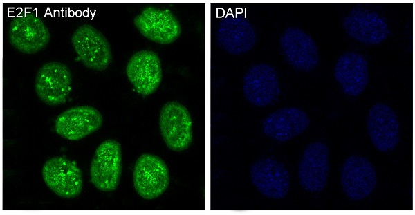 3 - Anti-E2F1 Rabbit Monoclonal Antibody ABO13491