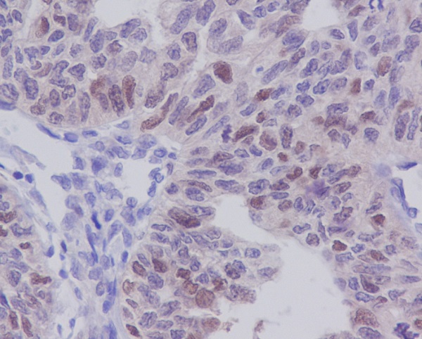 2 - Anti-E2F1 Rabbit Monoclonal Antibody ABO13491
