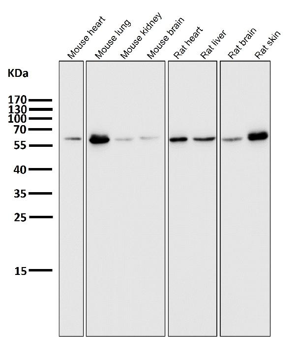 1 - Anti-E2F1 Rabbit Monoclonal Antibody ABO13491