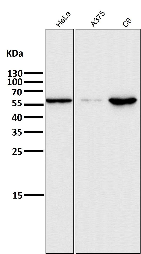 1 - Anti-E2F1 Rabbit Monoclonal Antibody ABO13491