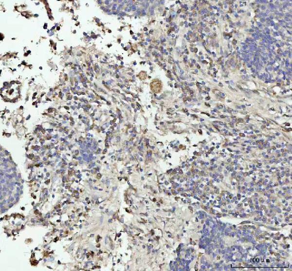 2 - Anti-GPX1/Glutathione Peroxidase 1 Rabbit Monoclonal Antibody ABO13493
