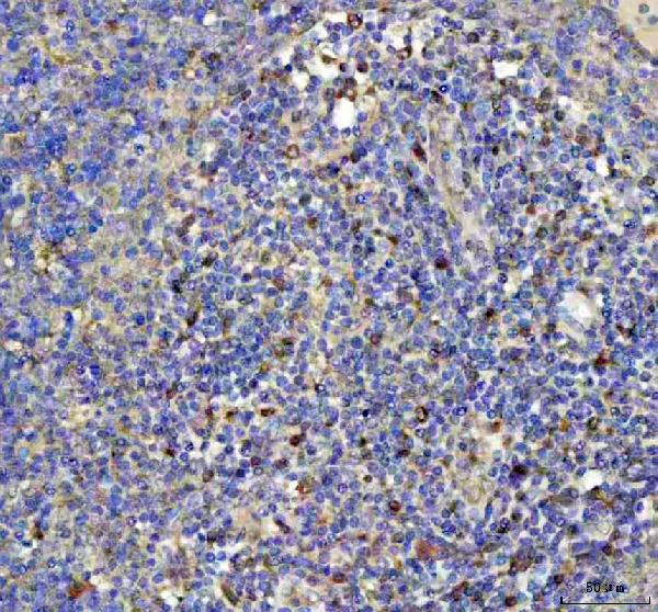 2 - Anti-GPX1/Glutathione Peroxidase 1 Rabbit Monoclonal Antibody ABO13493