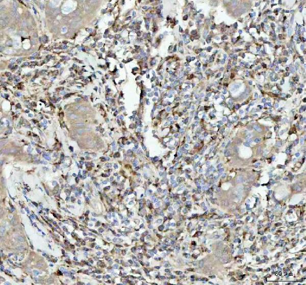 2 - Anti-GPX1/Glutathione Peroxidase 1 Rabbit Monoclonal Antibody ABO13493