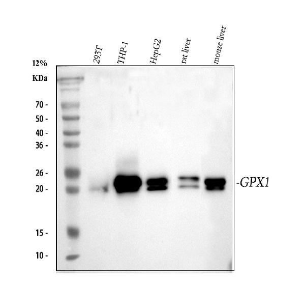 1 - Anti-GPX1/Glutathione Peroxidase 1 Rabbit Monoclonal Antibody ABO13493