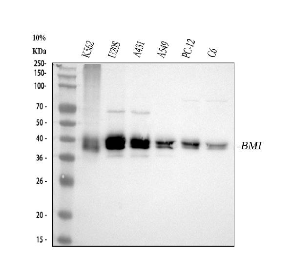1 - Anti-Bmi1 Rabbit Monoclonal Antibody ABO13494