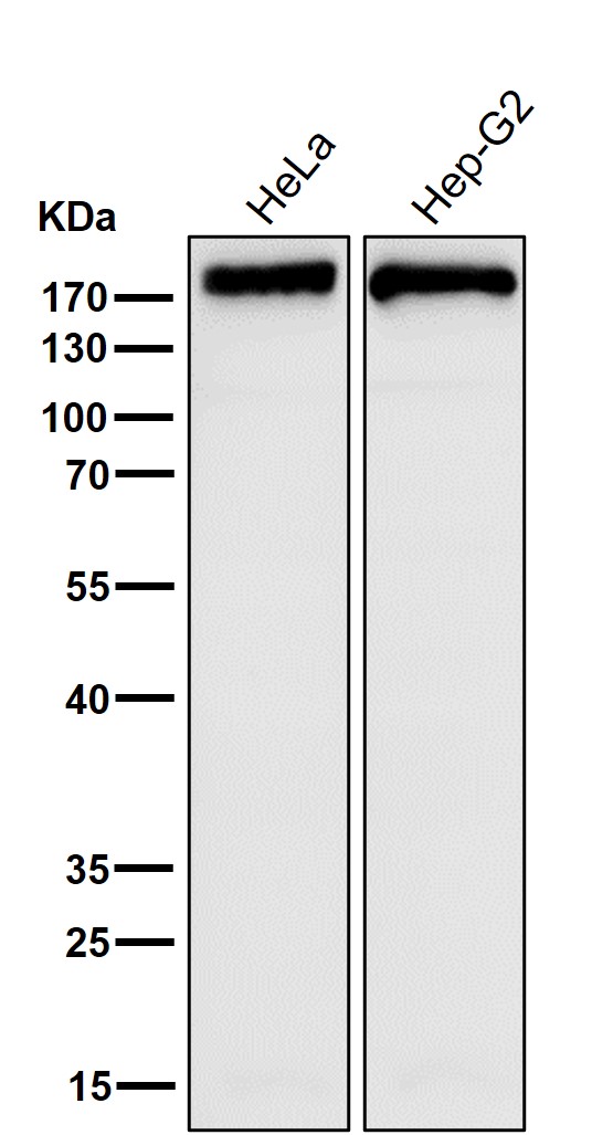 1 - Anti-FASN/Fatty Acid Synthase Rabbit Monoclonal Antibody ABO13495