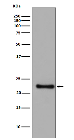 1 - Anti-GPX1/Glutathione Peroxidase 1 Rabbit Monoclonal Antibody ABO13496