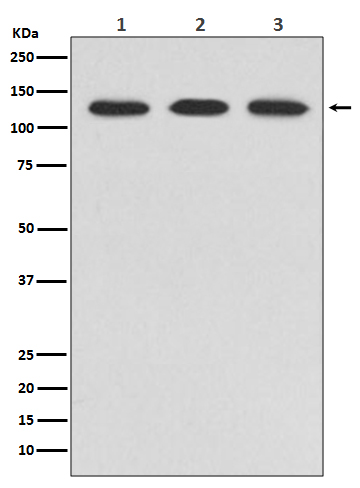 1 - Anti-ABL2 Rabbit Monoclonal Antibody ABO13497