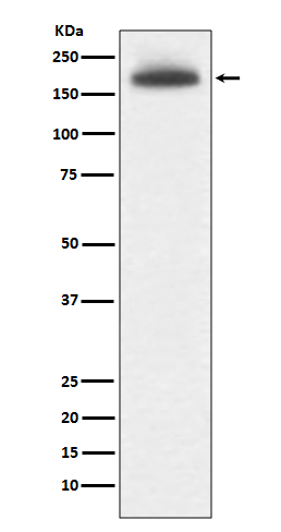 1 - Anti-MRC1/Cd206 Rabbit Monoclonal Antibody ABO13498