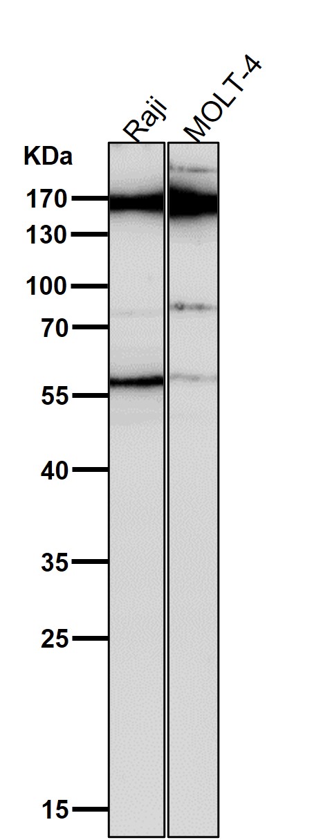 1 - Anti-MRC1/Cd206 Rabbit Monoclonal Antibody ABO13498