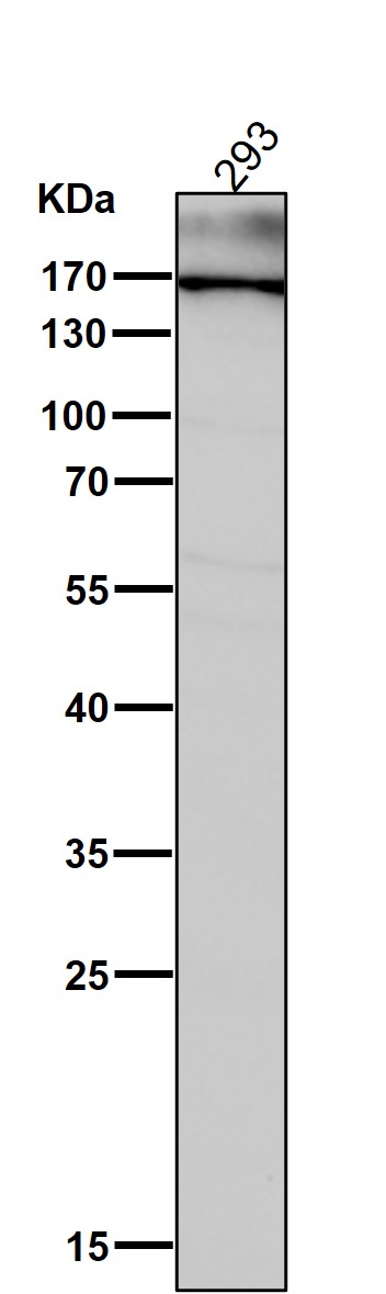 1 - Anti-MRC1/Cd206 Rabbit Monoclonal Antibody ABO13498