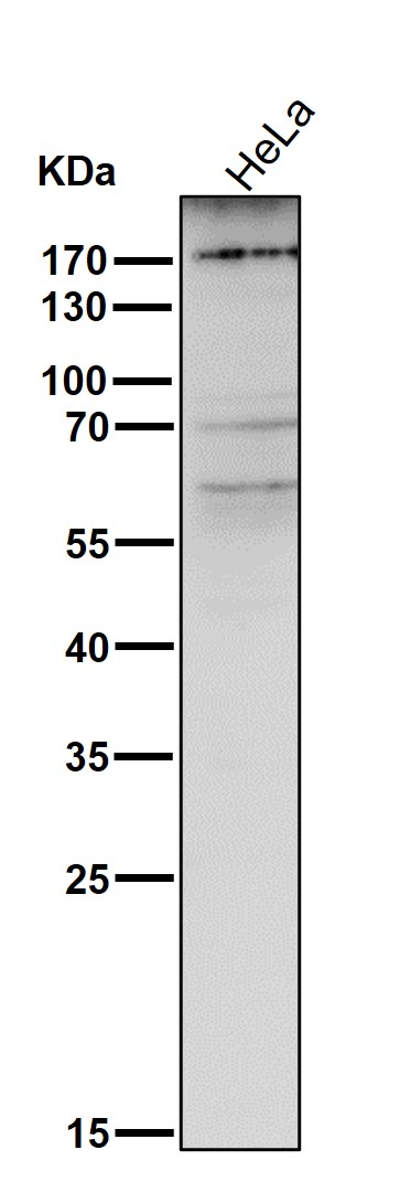 1 - Anti-MRC1/Cd206 Rabbit Monoclonal Antibody ABO13498