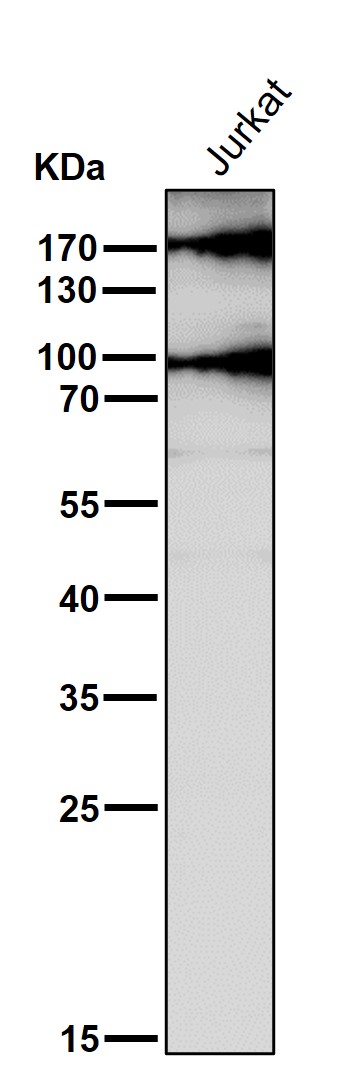 1 - Anti-MRC1/Cd206 Rabbit Monoclonal Antibody ABO13498