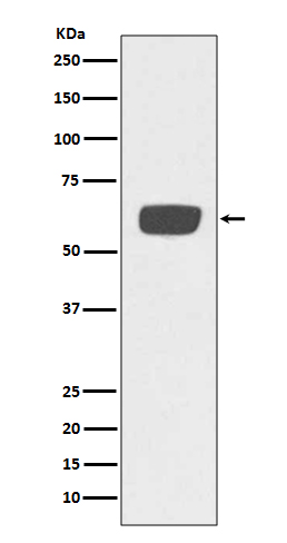 1 - Anti-PLAT/Tpa Rabbit Monoclonal Antibody ABO13499