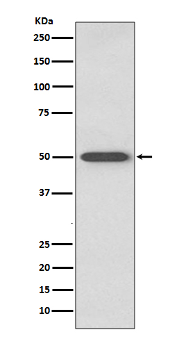1 - Anti-RAGE Rabbit Monoclonal Antibody ABO13500