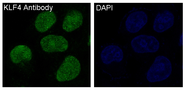 3 - Anti-KLF4/Gklf Rabbit Monoclonal Antibody ABO13501