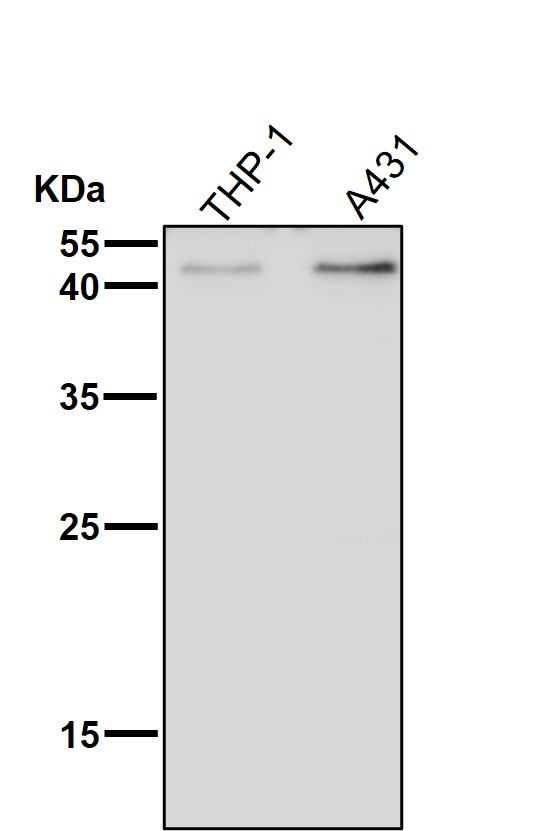 1 - Anti-KLF4/Gklf Rabbit Monoclonal Antibody ABO13501