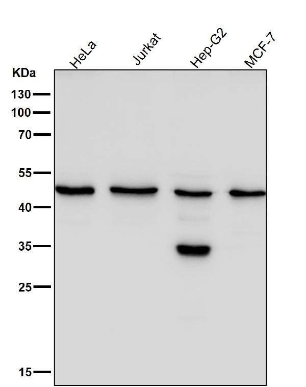1 - Anti-KLF4/Gklf Rabbit Monoclonal Antibody ABO13501