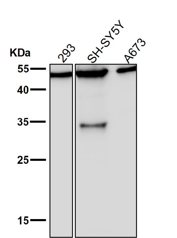 1 - Anti-KLF4/Gklf Rabbit Monoclonal Antibody ABO13501