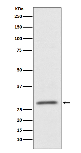 1 - Anti-CD99 Rabbit Monoclonal Antibody ABO13502