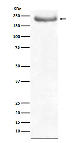 1 - Anti-NEFH/Nf H Rabbit Monoclonal Antibody ABO13503