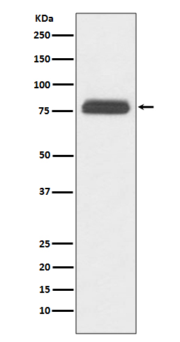 1 - Anti-TBR1 Rabbit Monoclonal Antibody ABO13505