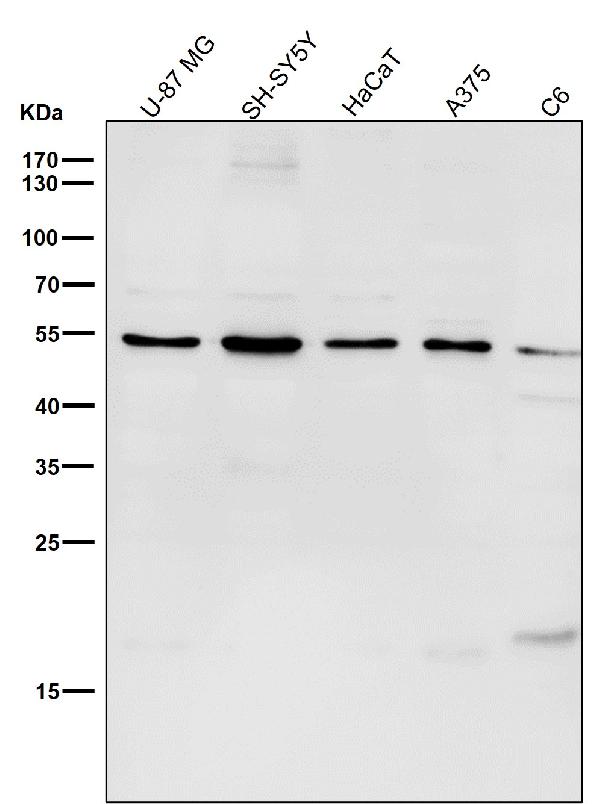 1 - Anti-MiTF Rabbit Monoclonal Antibody ABO13506