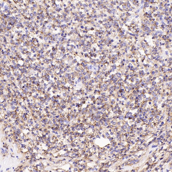 2 - Anti-CD19 Rabbit Monoclonal Antibody ABO13509