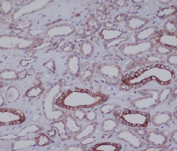 2 - Anti-THY1/Cd90 Rabbit Monoclonal Antibody ABO13510