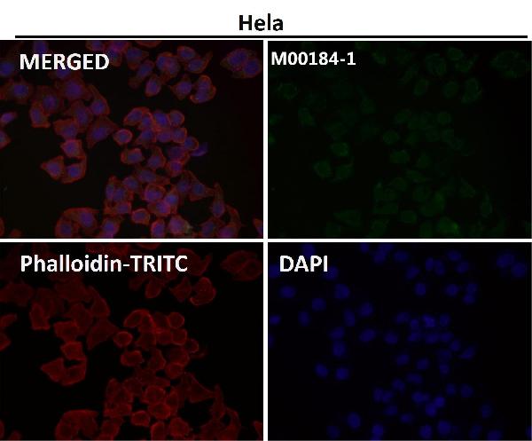 1 - Anti-NCAM NCAM1 Rabbit Monoclonal Antibody ABO13514
