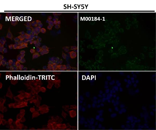 1 - Anti-NCAM NCAM1 Rabbit Monoclonal Antibody ABO13514