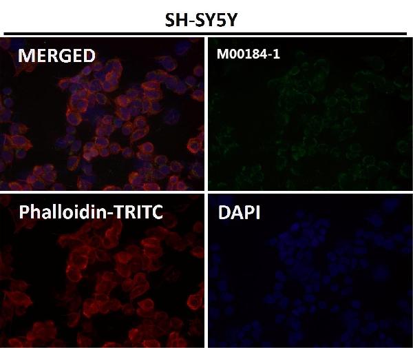 1 - Anti-NCAM NCAM1 Rabbit Monoclonal Antibody ABO13514