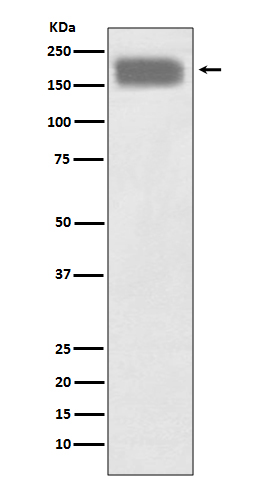 1 - Anti-NCAM NCAM1 Rabbit Monoclonal Antibody ABO13514