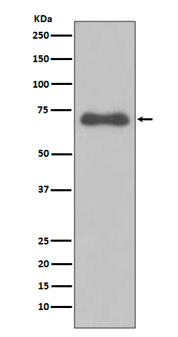 1 - Anti-NUMB Rabbit Monoclonal Antibody ABO13515