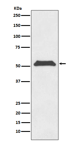 1 - Anti-TRF1 TERF1 Rabbit Monoclonal Antibody ABO13519