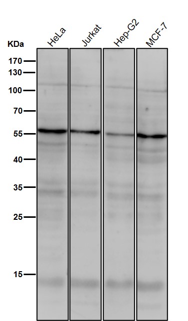 1 - Anti-TRF1 TERF1 Rabbit Monoclonal Antibody ABO13519