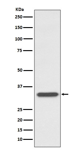 1 - Anti-CD74 Rabbit Monoclonal Antibody ABO13520