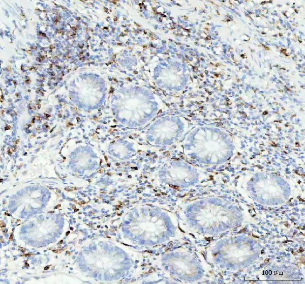 2 - Anti-CD74 Rabbit Monoclonal Antibody ABO13520